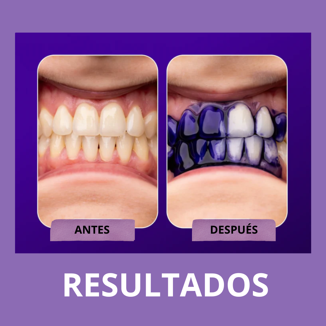 Adiós Amarillo: Sonrisa Radiante en 7 Días